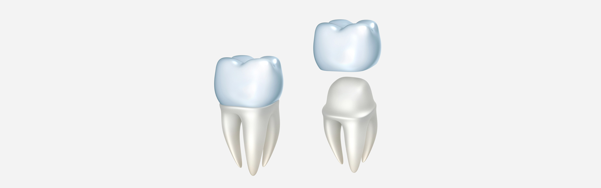 5 Reasons Why You Will Love CEREC® Dental Crowns