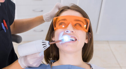 5 Awesome Benefits of Laser Dentistry
