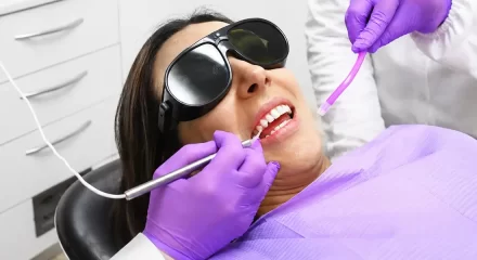 These Are the Advantages of Laser Dentistry