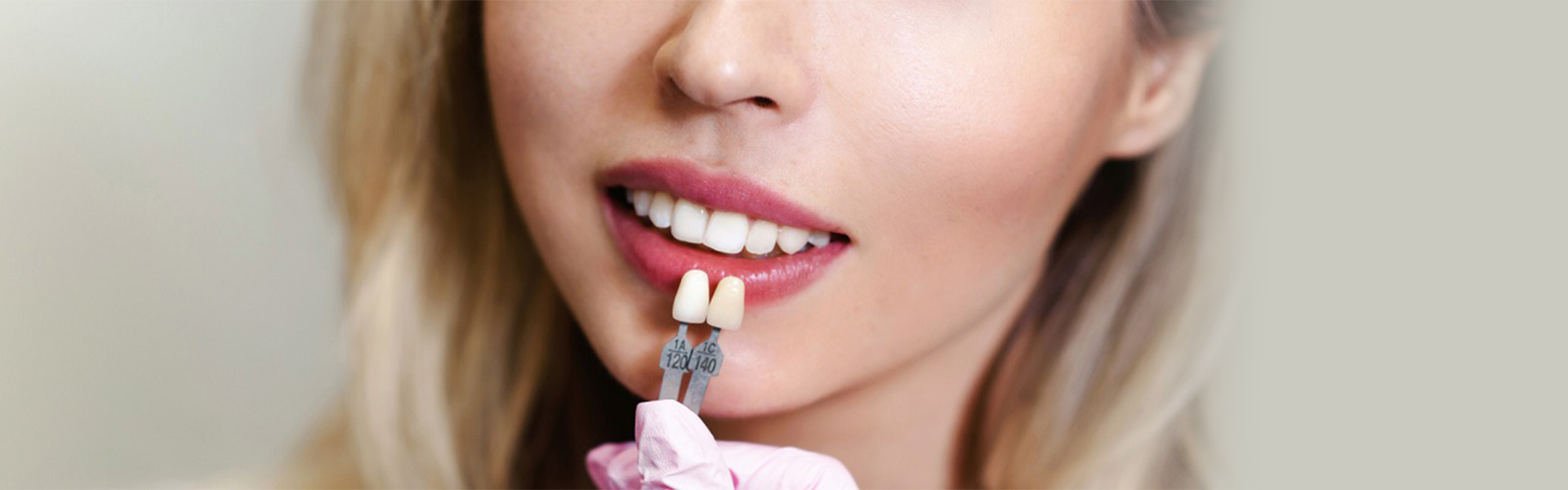 Dental Veneers 101: What You Need to Know Before Getting Them