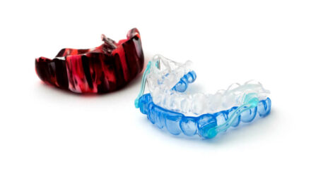Custom-made Sports Mouth Guard May Protect your Teeth