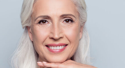 Dental Bonding for Your Dream Smile