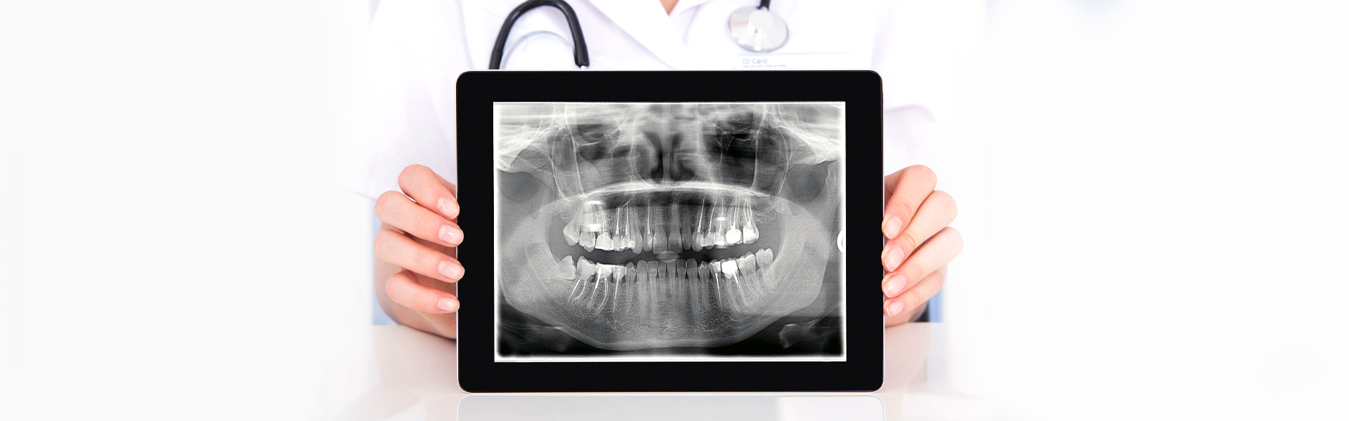 The Advantage of Digital X-Rays Medical Professionals Need to Be Aware of