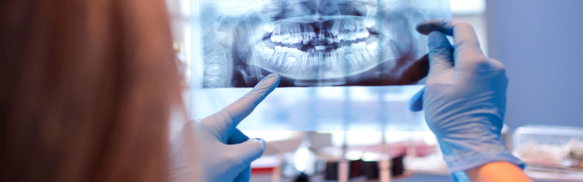Why do we take dental x-rays?